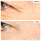 Plantinol™ Anti-Wrinkle Serum